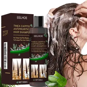 Scalp Flakes Antipruritic Hair Shampoo, Natural Extract Anti-Dandruff Treatment, Scalp Care, 100ml