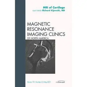 USED-MRI of Cartilage, an Issue of Magnetic Resonance Imaging Clinics: Volume 19-2 by Kijowski, Richard (Hardcover)