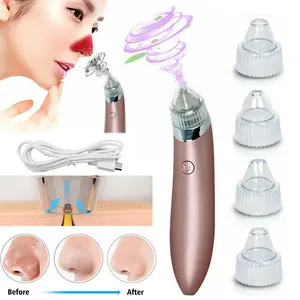 Pro-Grade Pore Vacuum & Blackhead Extractor