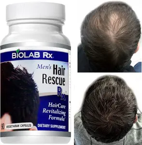 Biolab Rx Hair Growth Booster | Hair Loss | Regrow Hair | Increase Thickness | 100% Natural Hair care