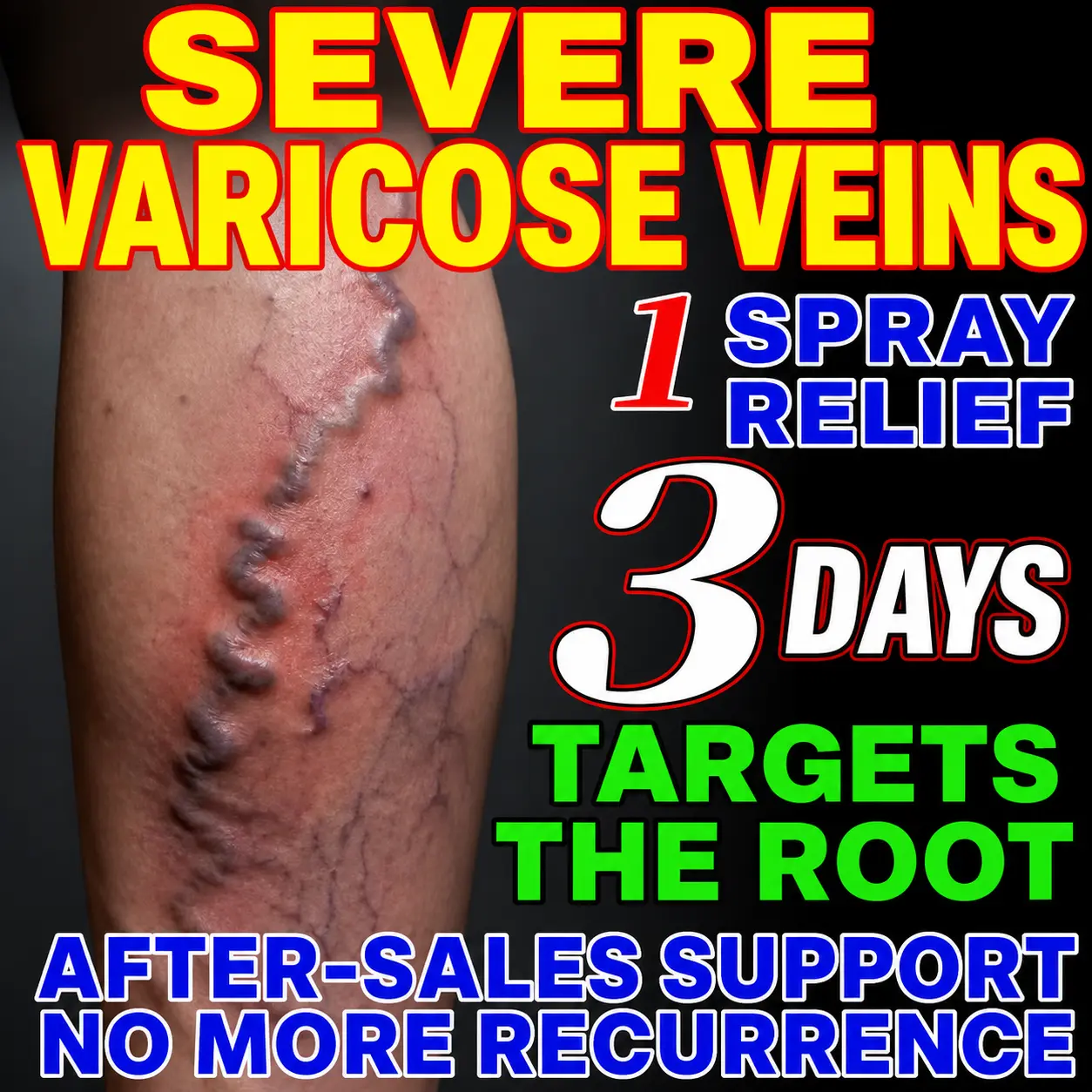 Venous Varicosities Repair Cream for Body Moisturizing - Soothes Heavy Leg Discomfort & Pain, Reduces Lower Limb Edema (Reduces Swelling), Diminishes Distorted Leg Veins, Alleviates Blood Stagnation & Calf Stiffness from Prolonged Sitting