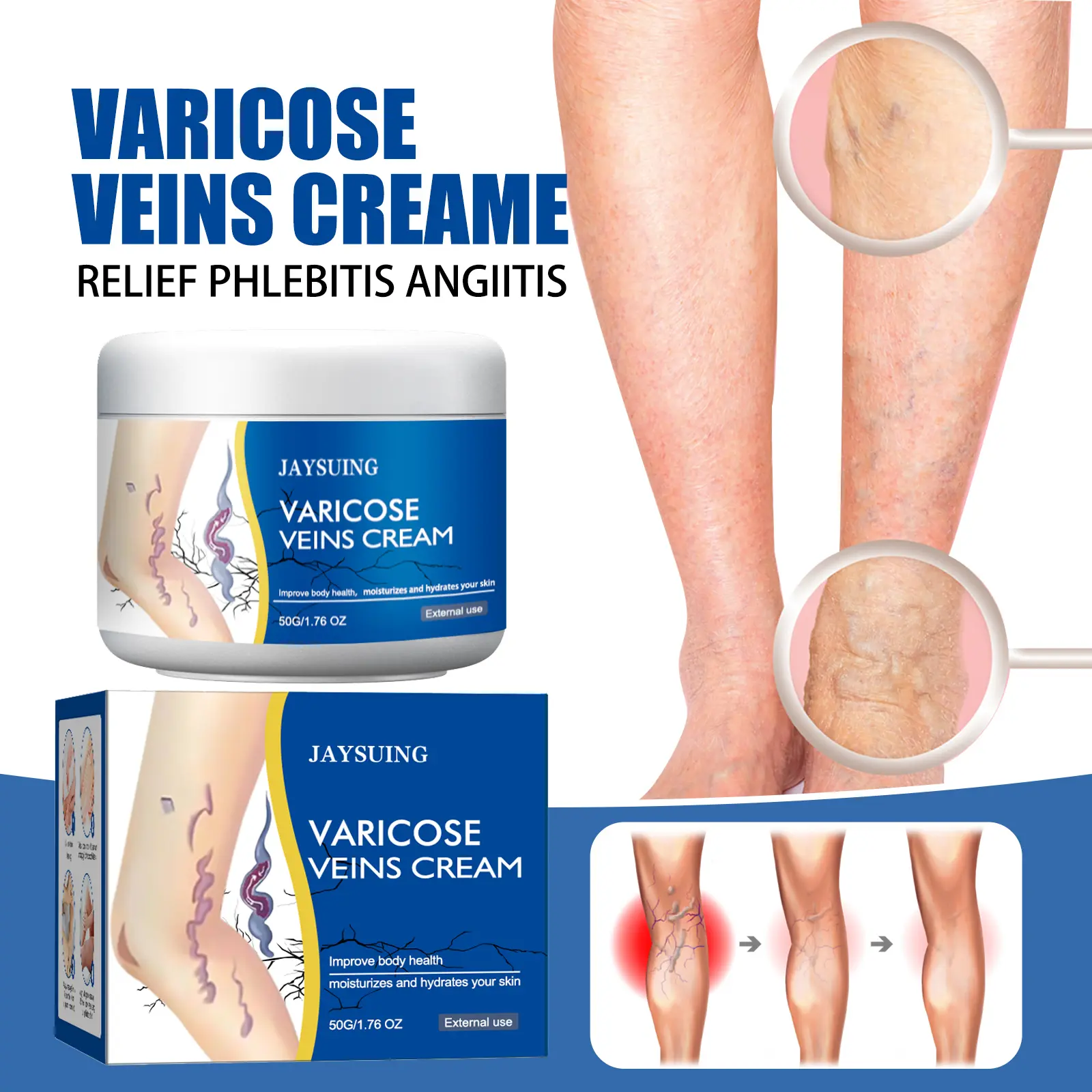 JAYSUING Exercise Repair Relieve Veins Leg Repairing Cream - Moisturizing Body Care for Leg Relief, Cocoa Butter Formula Moisturizer Soothing