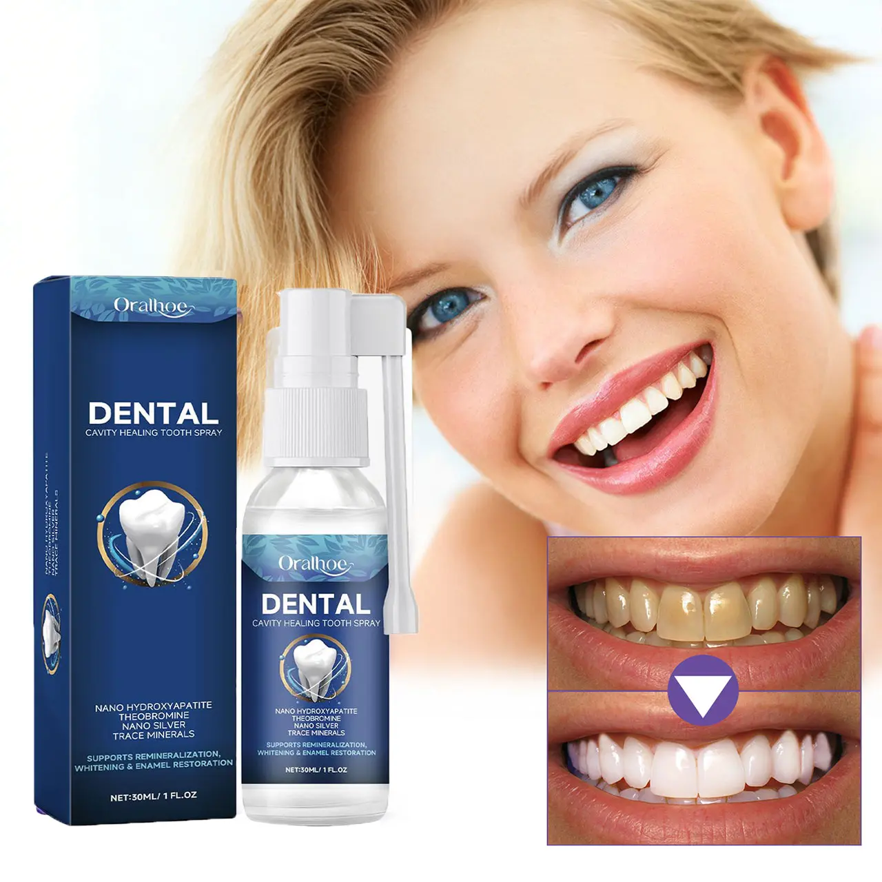 Oralhoe Tooth Care Spray 1 Enamel Repair, Whitening &Fresh Breath | Gentle Oral Care for Daily Dental Hygiene