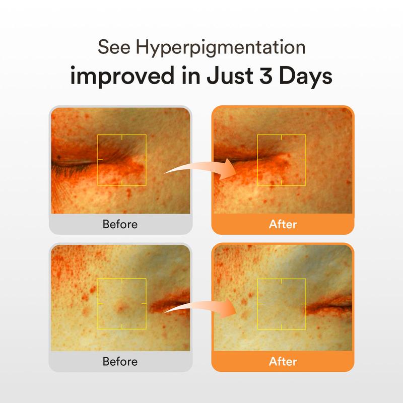 [Abib Official] Radiance Spot-Correcting Glow Trio | Glutathione Serum, PDRN Eye Patch & Lip Balm