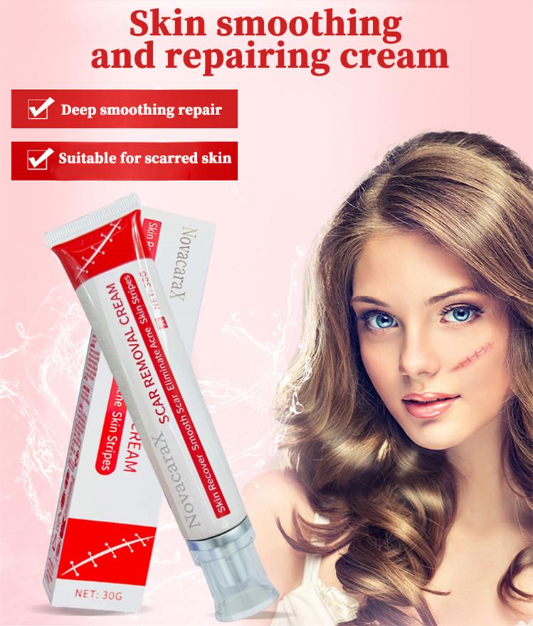 Professional and powerful scar removal gel - suitable for scar removal treatment of post-operative scars, caesarean section scars, keloids, burns, acne, etc.-A Professional and powerful scar removal gel - suitable for scar removal treatment of post-operative scars, caesarean section scars, keloids, burns, acne, etc.-A