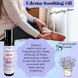 Edema Soothing Oil | Pregnancy Safe | 10ml Roller