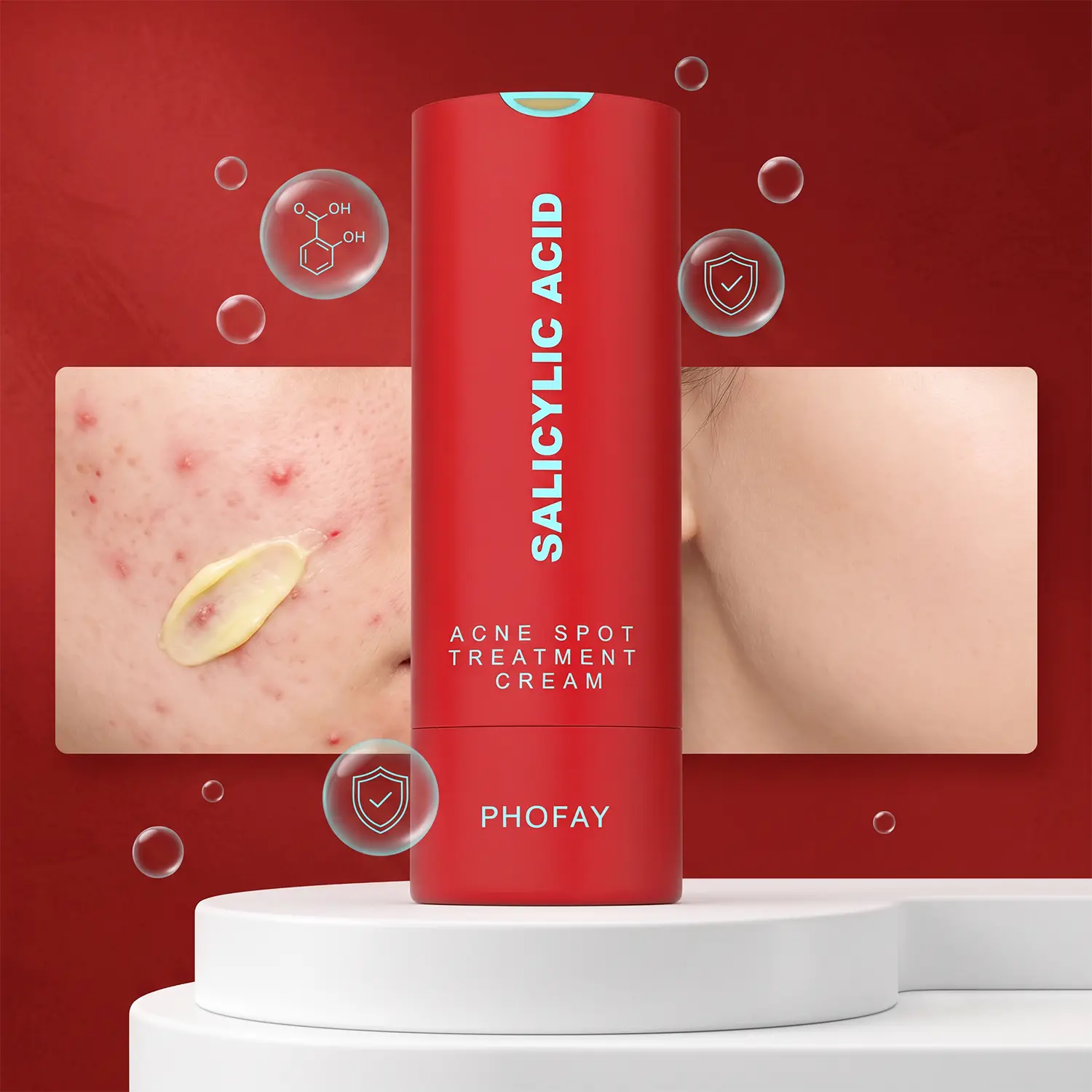 Drying Lotion | Pimple Treatment & Body Acne Treatment | Visibly Shrinks Pimples & Helps Fade Acne Marks | With 1% Encapsulated Salicylic Acid, Niacinamide & Centella Asiatica Root Extract
