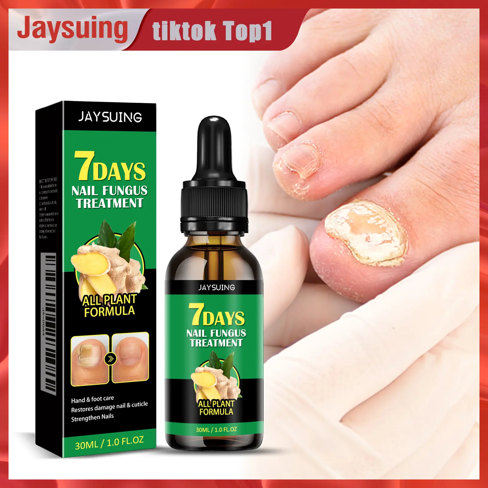 Toenail Fungus Treatment Solution - Infused with Ginger Extract and Vitamin E, a Daily Care Formula Designed for Brittle and Thickened Nails