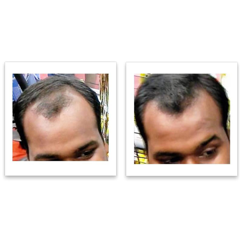 Caboki 10X Hair Powder - LIMIT ONE PER HOUSEHOLD. Full Coverage for Hairline & Thin Areas, Talc-Free Formula, Natural Ingredients, Waterproof, TRIAL SIZE