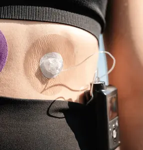 Overt Insulin Pumps, 0.8-Inch Hole, Waterproof, Breathable & Clear Patches [ 5 Pack ]