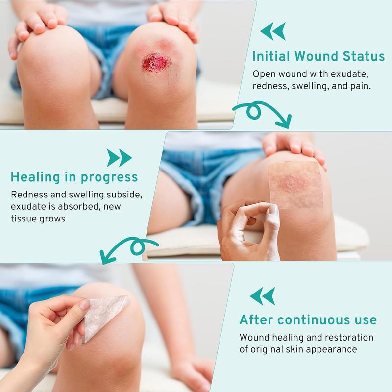 Upadated hydrocolloid Bandages,2in*12ft Hydrocolloid Roll for Wound Care,Medical-Grade Hydrocolloid Patch Bandages with Self-Adhesive, Flexible & Waterproof DIY Size & Shape (2in*12ft)