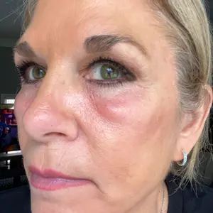 Product Review of Peter Thomas Roth Instant FIRMx Eye Temporary Eye Tightener, Instant Firming Under-Eye Cream, Minimize Appearance of Under-Eye Bags and Puffiness from k**a