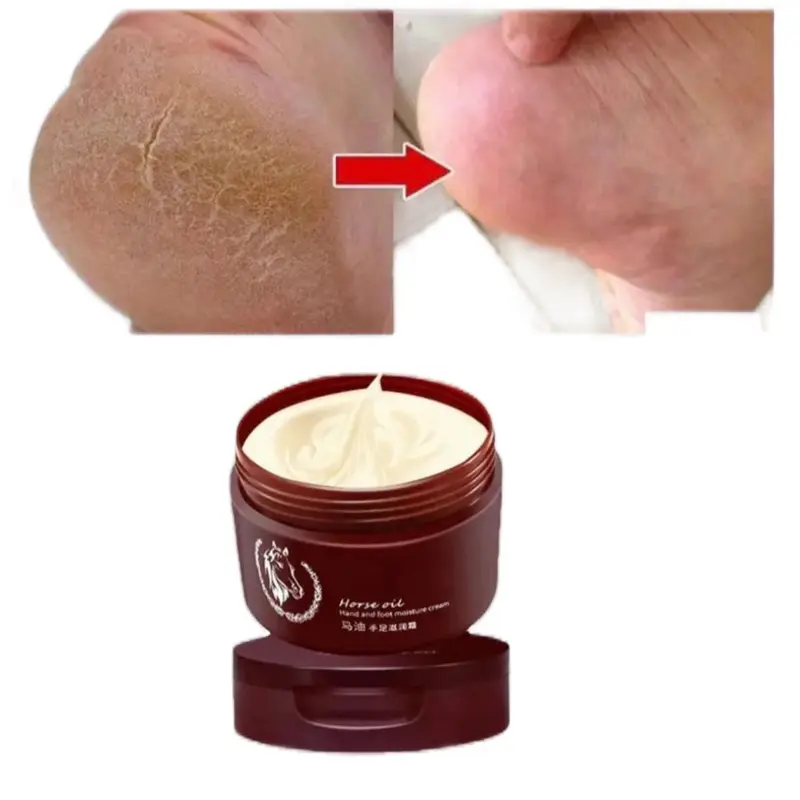 Foot cream repair, cracking feet, Moisturize Hydrate