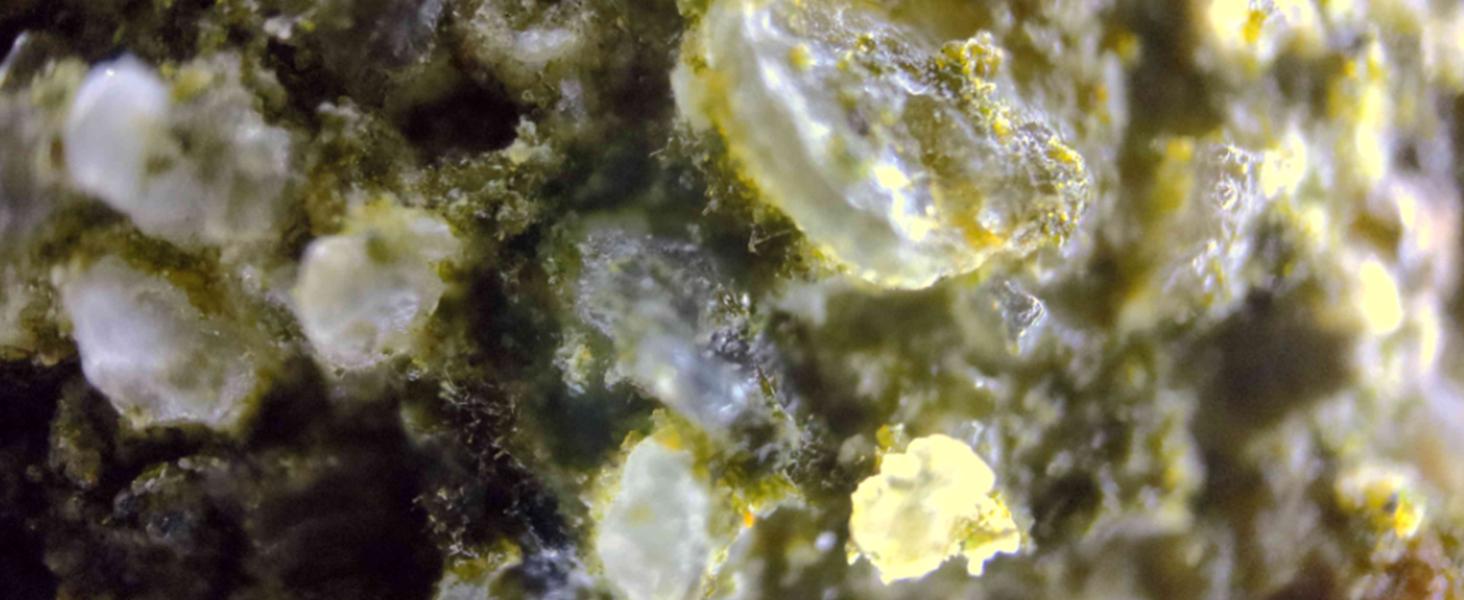 MicroCam X1 Mini Microscope Camera 400X – See Skin, Bugs & Hidden Details in 4K | Pocket Digital Microscope MicroCam X1 Mini Microscope Camera 400X – See Skin, Bugs & Hidden Details in 4K | Pocket Digital Microscope