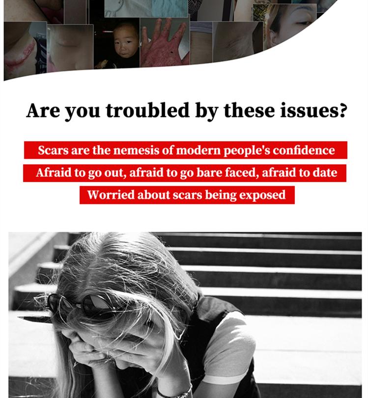 Professional and powerful scar removal gel - suitable for scar removal treatment of post-operative scars, caesarean section scars, keloids, burns, acne, etc.-A Professional and powerful scar removal gel - suitable for scar removal treatment of post-operative scars, caesarean section scars, keloids, burns, acne, etc.-A