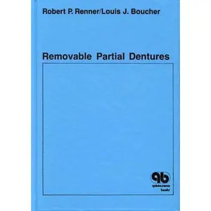 USED-Removable Partial Dentures by Robert P. Renner (Hardcover)