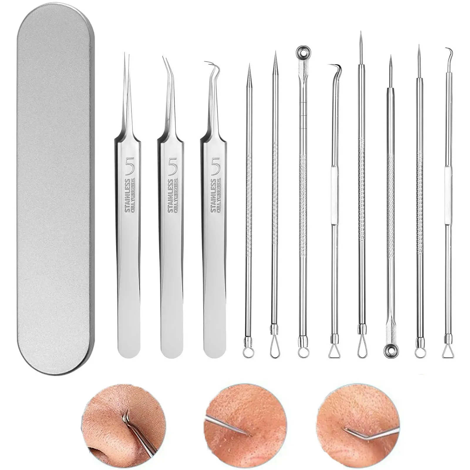 Blackhead Remover Whitehead Remover Facial Cleaning Tool Silver Pimple Needle
