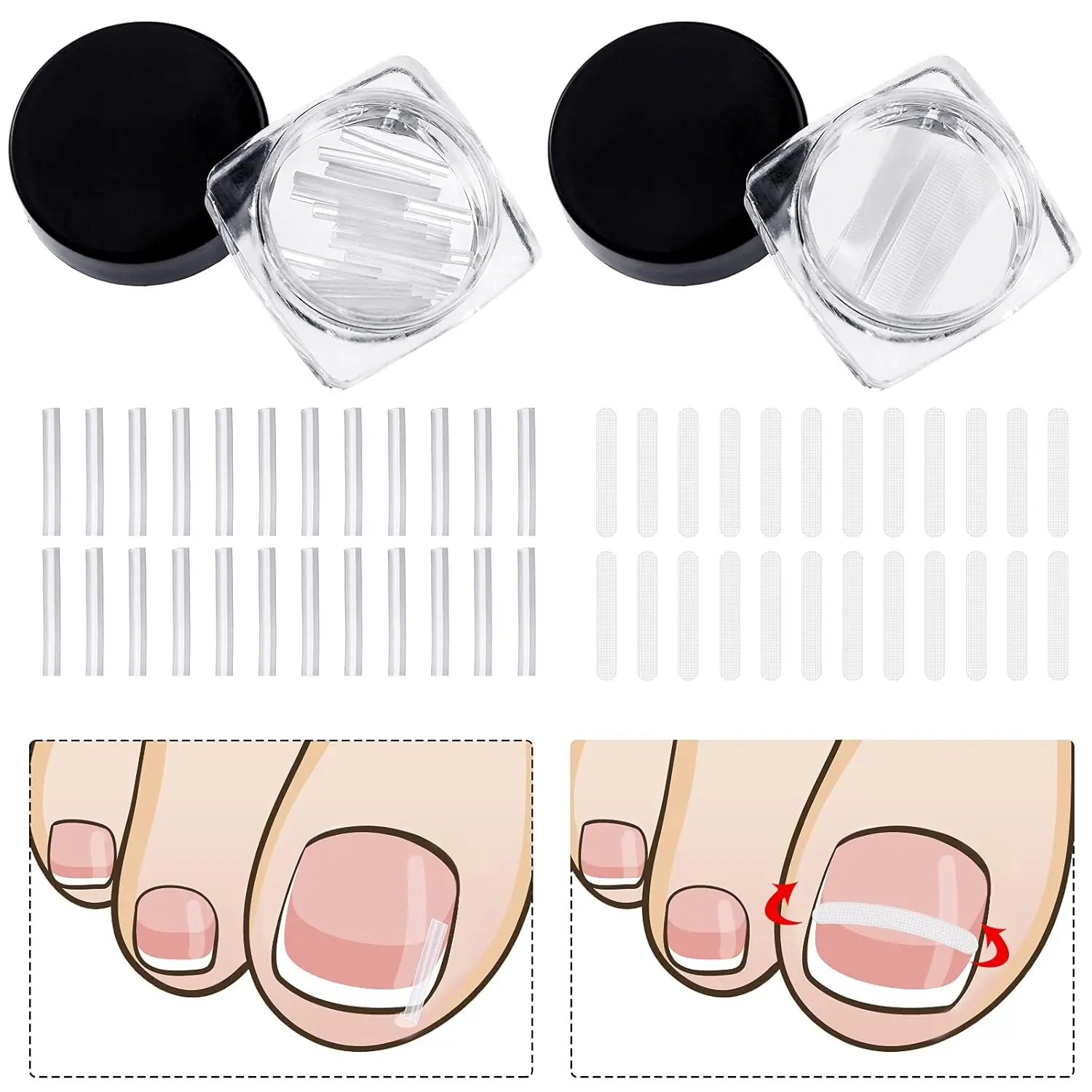 Ingrown Toenail Correction Strips | C-shaped Braces for Curved Nails, Toenail Straightener for Men & Women, Professional Foot Care Solution