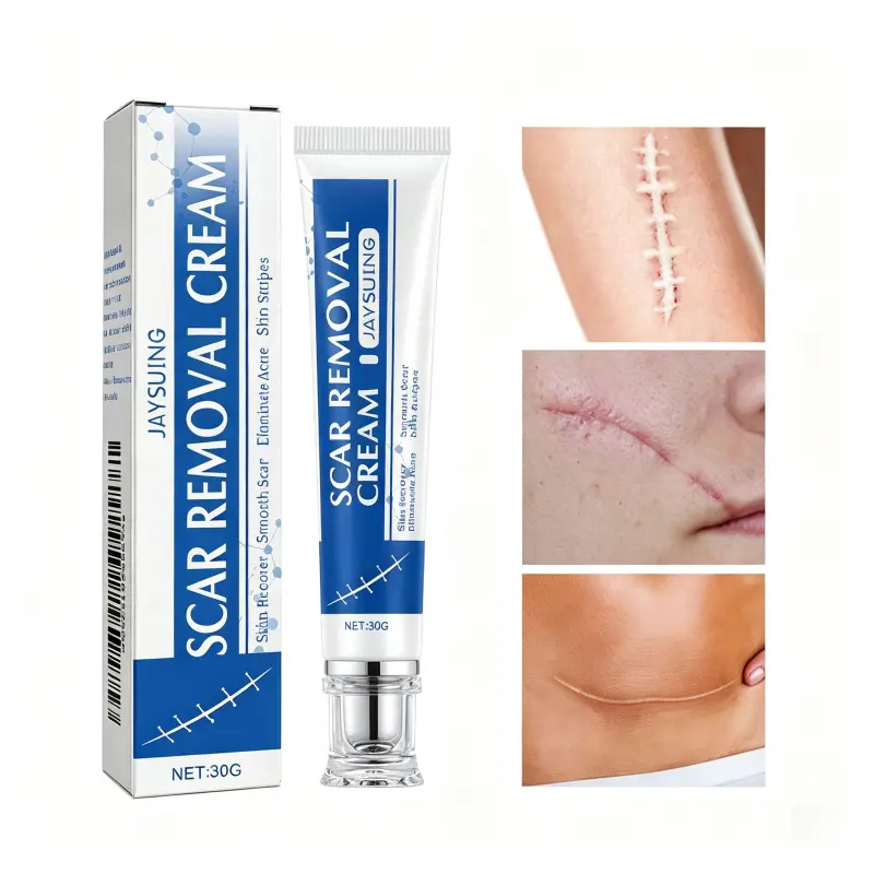 Scar Removal Cream, Effective Scar Treatment for Surgical Scars, Stretch Marks, Acne Scars, Keloid & Hypertrophic Scars, Skin Repair Gel for Old & New Scars
