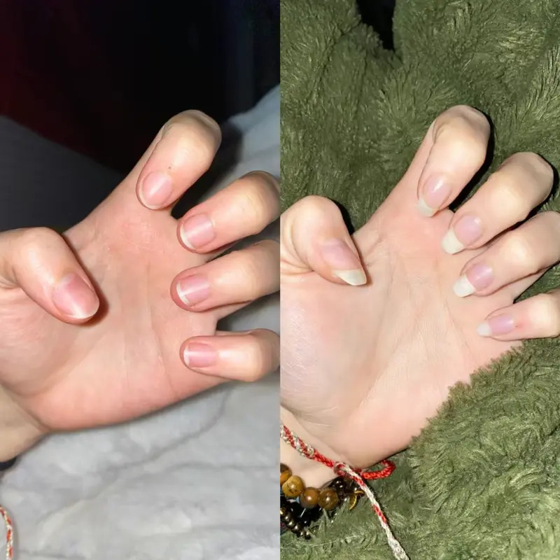 Radiant Cosmetics Nail Growth Oil - 100% Organic, Moisturizing, Growth, Strengthening, and Brightening Formula with Vitamins and Fatty Acids for Overall Nail Health 8