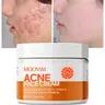 MOOYAM 50ml Acne Scar Treatment Cream - Centella & Snail Repair Cream with Salicylic Acid, Dark Spot Remover, Blemish Removal Benefits, Fragrance-Free, Paraben-Free for Sensitive Teens & Adults Skin Products (Acne Treatments)