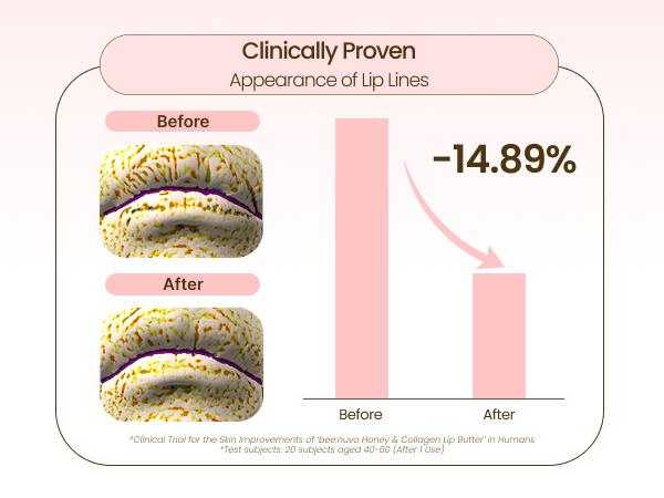beenuvo Honey & Collagen Lip Butter - Honey Lip Balm for Deep Moisture & Skincare | 13g | Daily Lip Moisturizer