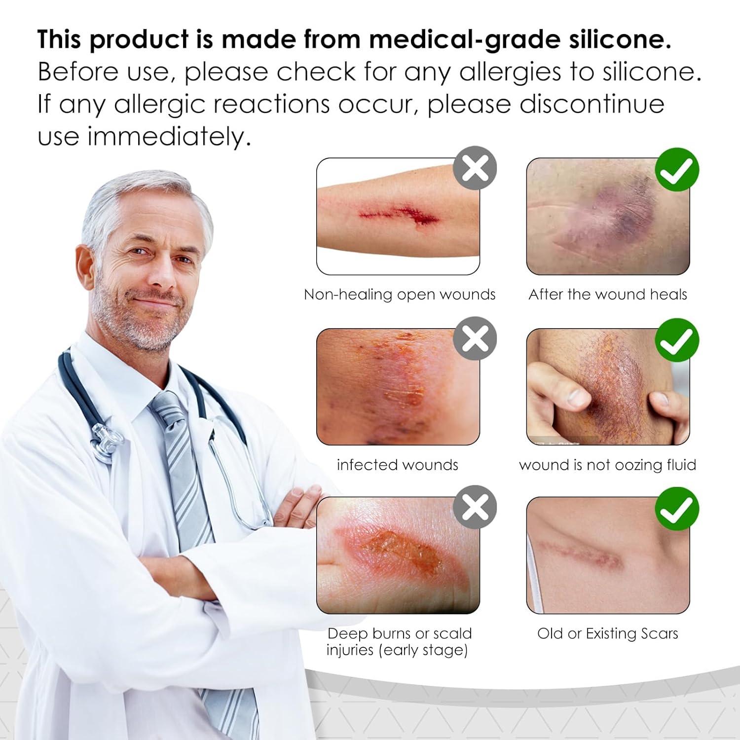 Silicone Scar Sheets,Silicone Scar Tape for Removal Treatment,Medical Grade Scar Tape for Surgical Scars,C-Section,Tummy Tuck,Scar Removal Away(1.6" x 60" Roll - 1.5M)