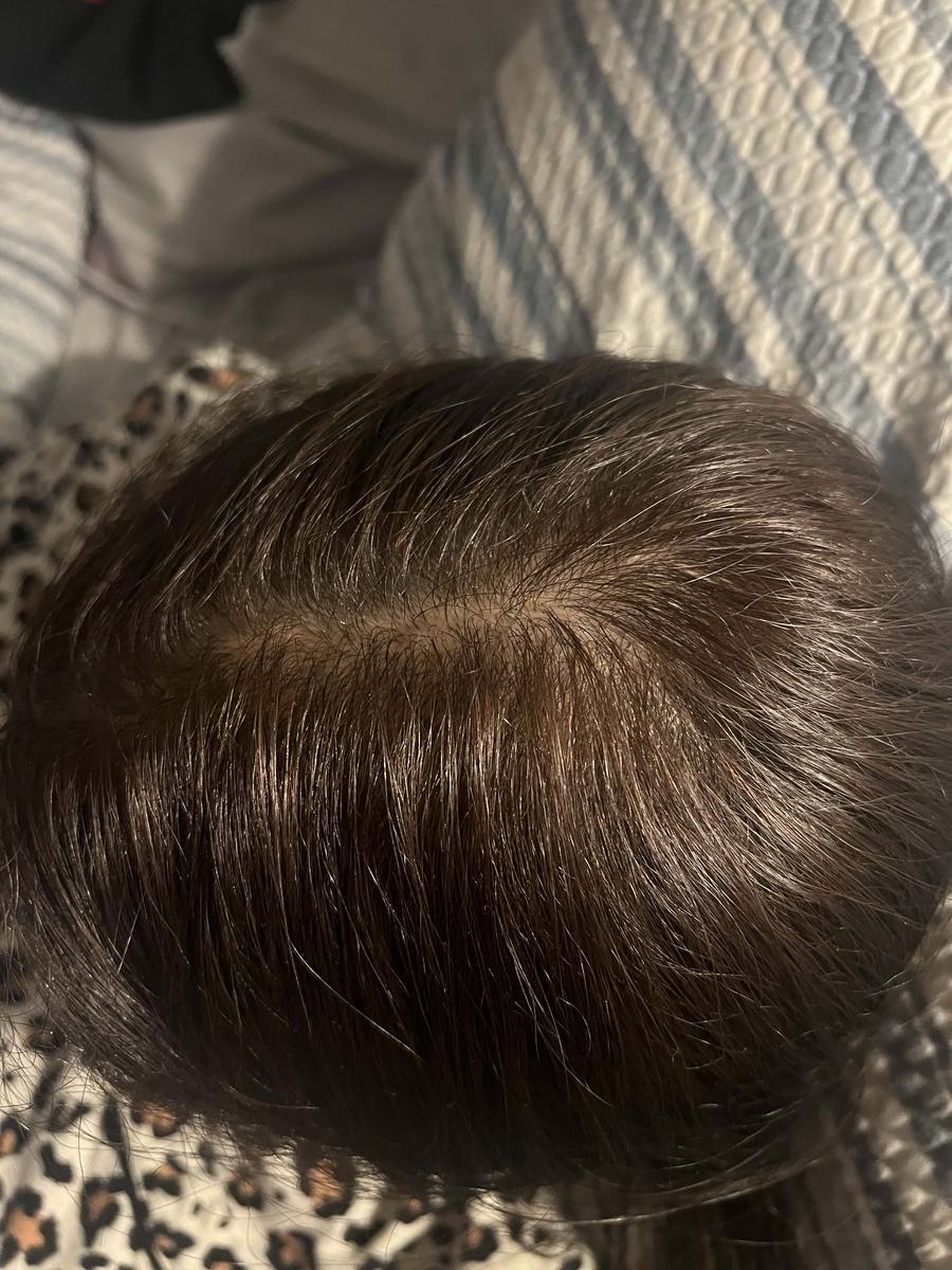 Item: Selenium Disulfide Shampoo 300ML