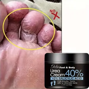 120g Urea 40% and Salicylic Acid 2% Moisturizing Foot Cream, Heals Dry Cracked Skin, Gentle Formula for Quick Absorption, Exfoliates Dead Skin, Foot Dead Skin Remover