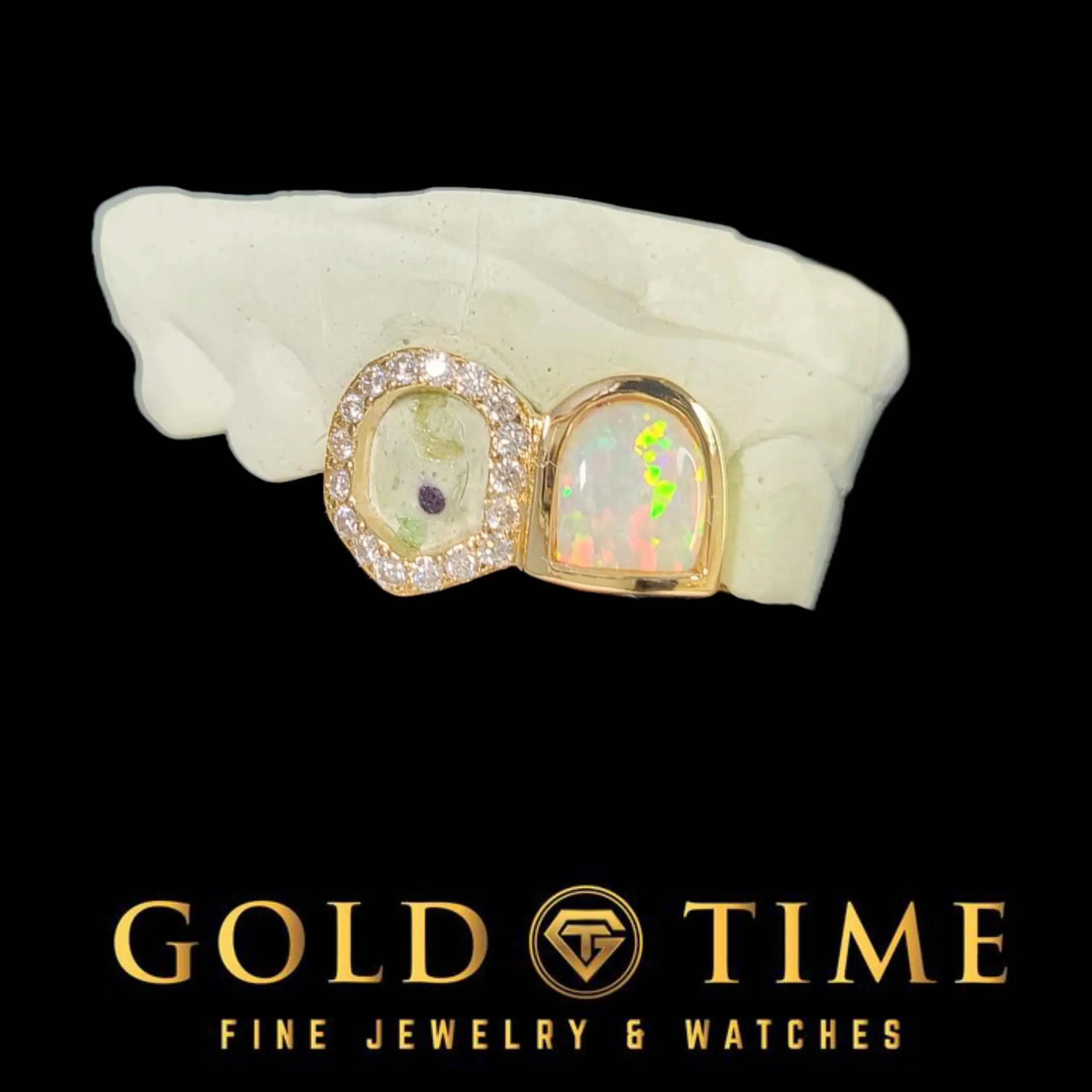 Custom Double Cap Grillz - Opal Incisor, Open Face Moissanite Fang, Silver/Gold Costume Jewelry Gift