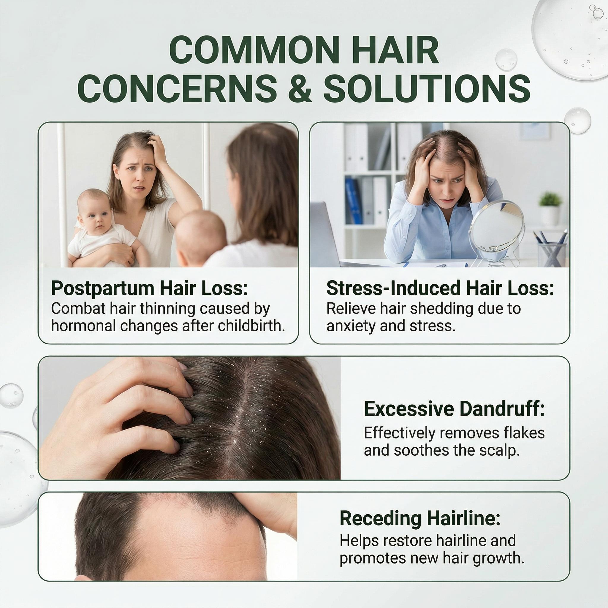 Korean Scalp Serum with Built-in Massager for Thinning Hair, Peptide Complex Formula Promotes Hair Volume, Strengthens Hair Roots, Soothes & Nourishes Scalp, Plant-Based Bio-Active Hair Care, 100 ml