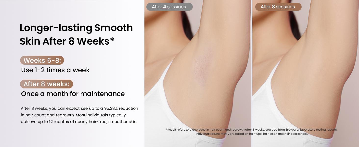 Laser Hair Removal Ice Cooling, Painless IPL Laser Hair Removal Device At-Home Permanent ipl device Portable IPL Smooth Comfort IPL Hair hair remival