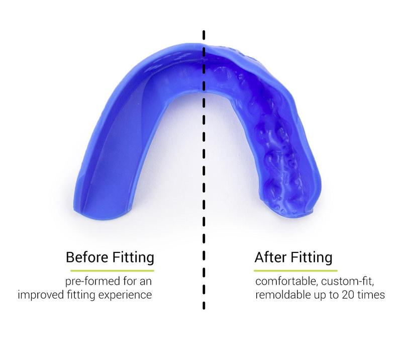 3D Custom Fit Mouthguard