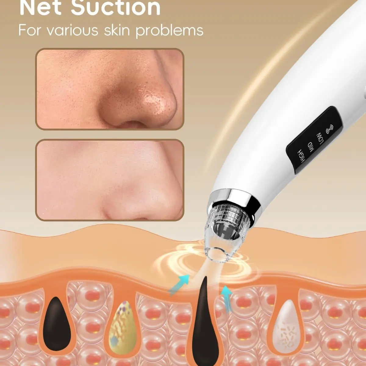 Pore Vacuum Blackhead Remover, Facial Pore Cleaner, Blackhead Tools, 5 Probes, USB Rechargeable Blackhead Vacuum Kit, Lithium Battery, New Condition
