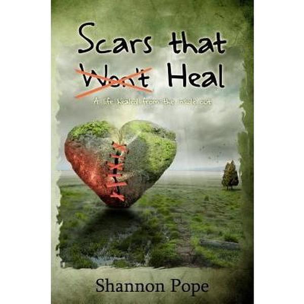 USED-Scars That Heal: A life healed from the inside out by Shannon Pope (Paperback)