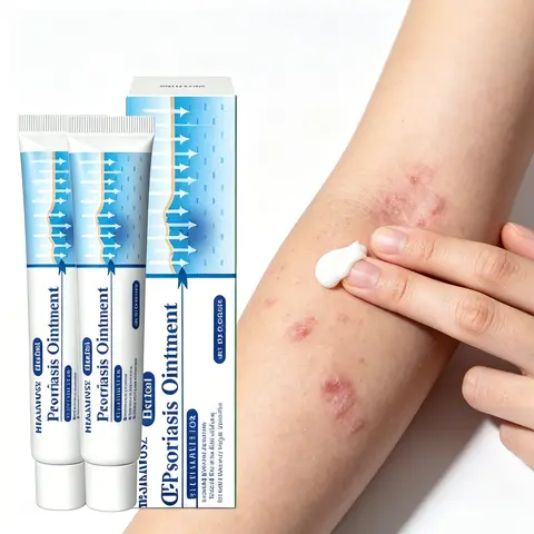 TikTok Viral Psoriasis & Fungus Treatment Cream - Extra Strength Nature Multi Purpose Ointment - Fast Itch Relief, Deep Hydration, Soothing, Prevents Flare-Ups - Derm-Tested Safe, Repairs Dry Flaky Skin - 20g