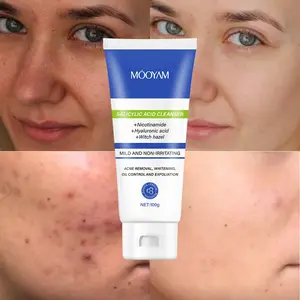 Salicylic Acid Acne Control Cleanser, Oil-Control Face Wash, Effective Pimple Treatment, Gentle Skin Care, Daily Use