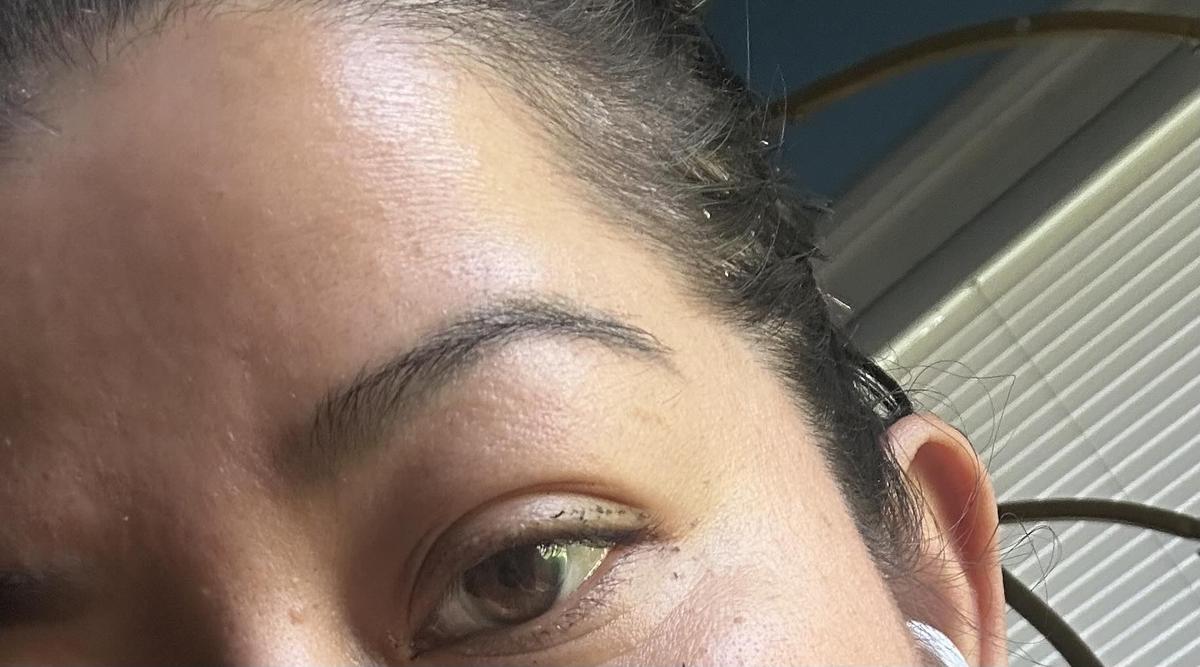 Item: 【Buy 2 Get 1】For Severe Oiliness / Dandruff / Itch