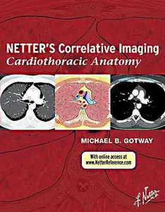 USED-Netter's Correlative Imaging: Cardiothoracic Anatomy by Gotway, Michael B. (Hardcover)