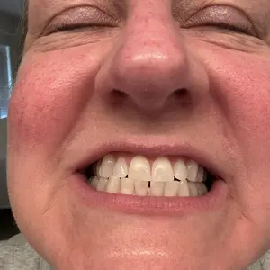 Product Review of GuruNanda Whitening Strips, 7-day treatment (7 Packets - 2 Strips per pack) - Non-Slip, Dry Strip Technology from L**a ** S**