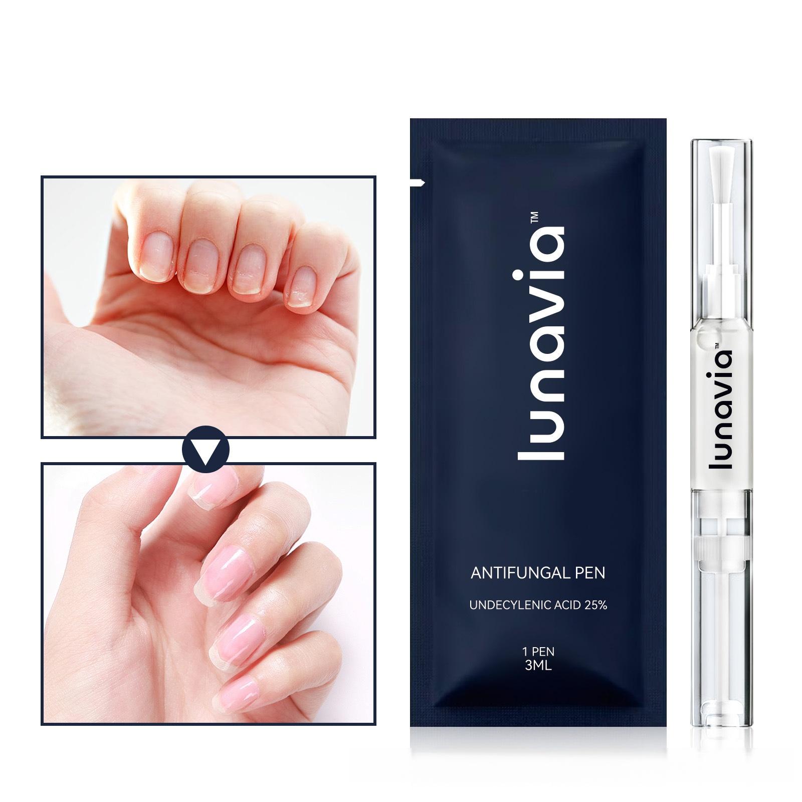 Lunavia Antifungal Pen - UNDECYLENIC ACID 25% - Cures Most Athlete’s Foot, Jock Itch, and Ringworm