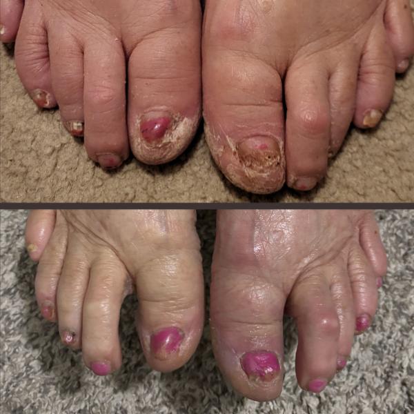 Sap Chap Hand & Foot Cream - All-Natural Whipped Moisturizer for Dry Skin & Cracked Feet - 80g - Chemical-Free, Preservative-Free, Handmade in Small Batches