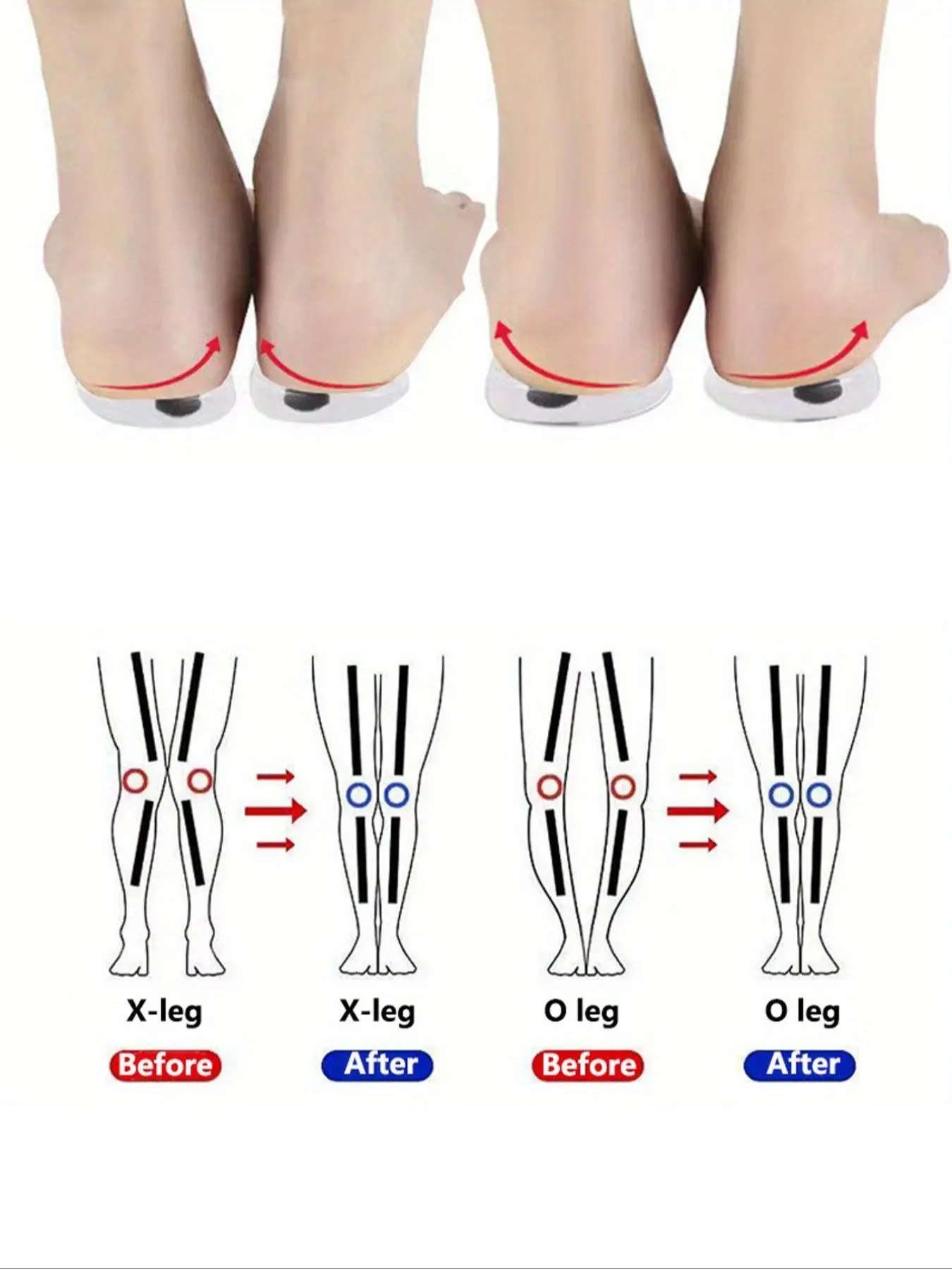 1 Pair Shoe Insoles, Women's O/X Leg Shoe Pad, Magnetic Heel Cushion, Cushioning Insoles, Arch Support Insoles, Plantar Fasciitis Insoles, Soft Cushioned Insoles, Anti-slip Shoe Inserts For Women & Men