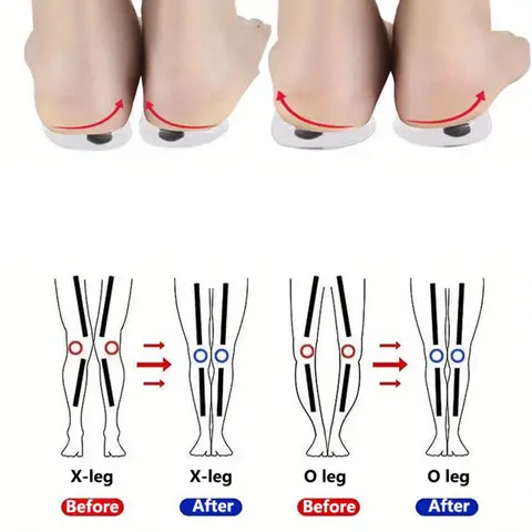 1 Pair Shoe Insoles, Women's O/X Leg Shoe Pad, Magnetic Heel Cushion, Cushioning Insoles, Arch Support Insoles, Plantar Fasciitis Insoles, Soft Cushioned Insoles, Anti-slip Shoe Inserts For Women & Men