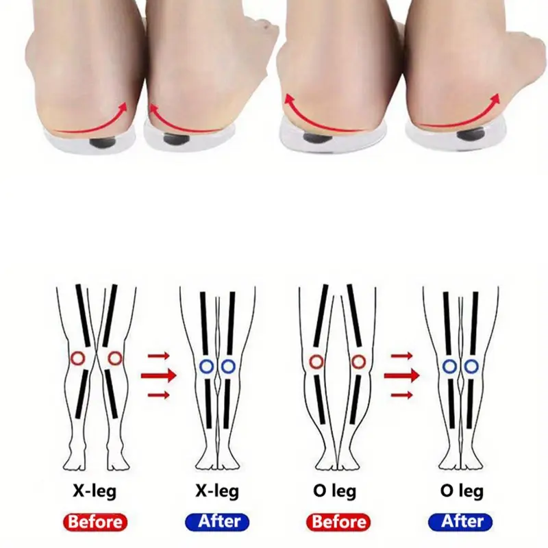 1 Pair Shoe Insoles, Women's O/X Leg Shoe Pad, Magnetic Heel Cushion, Cushioning Insoles, Arch Support Insoles, Plantar Fasciitis Insoles, Soft Cushioned Insoles, Anti-slip Shoe Inserts For Women & Men