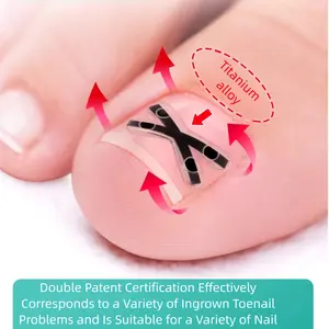 Titanium Alloy Ingrown Toenail  Treatment , Ingrown Toenail Removal kit, Professional ingrown Toenail Corrector, Nail Care, Quick Repair Ingrown Nail Treatment Tool No Regular Change Elasticity Upward Pulling Force Strong Adhesion