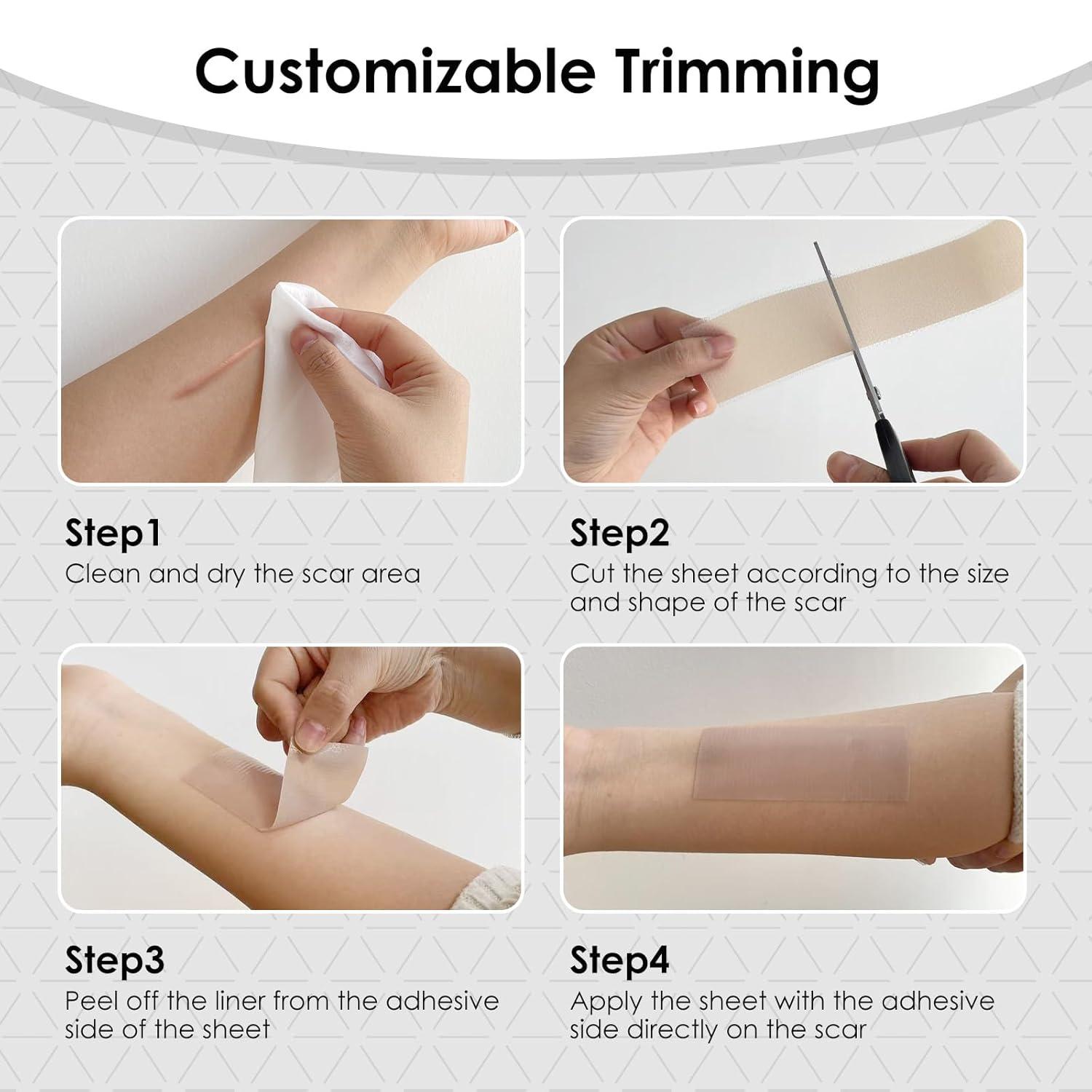 Silicone Scar Sheets,Silicone Scar Tape for Removal Treatment,Medical Grade Scar Tape for Surgical Scars,C-Section,Tummy Tuck,Scar Removal Away(1.6" x 60" Roll - 1.5M)