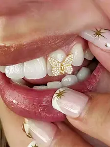 Butterfly Gold Teeth Grillz for Women Grills for Your Teeth Men Gold Tooth Cap Grillz for Women Golden Tooth Jewelry Mouth Grills Rhinestone Hip Hop Outfits Custom Accessory Halloween Party Customizable Option Hip Hop Influence