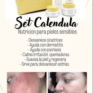 Set Calendula Skin Repair Body Care - Comfort Cosmetics