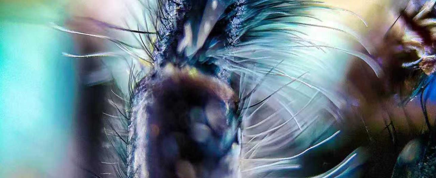 MicroCam X1 Mini Microscope Camera 400X – See Skin, Bugs & Hidden Details in 4K | Pocket Digital Microscope MicroCam X1 Mini Microscope Camera 400X – See Skin, Bugs & Hidden Details in 4K | Pocket Digital Microscope